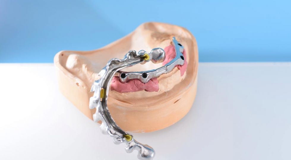 Screenshot 3-D Diagnostik
